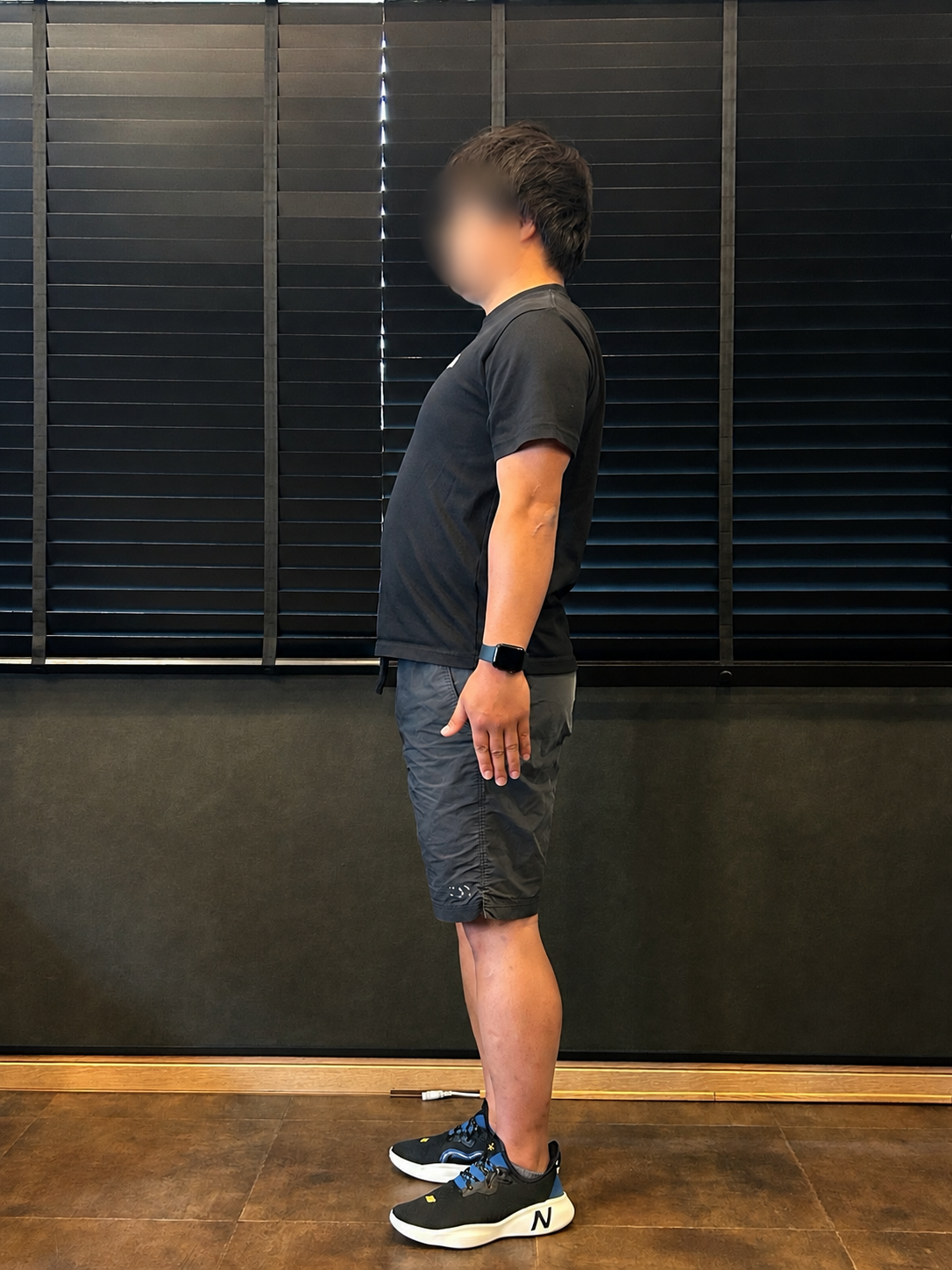 M・Yさん ビフォー 側面