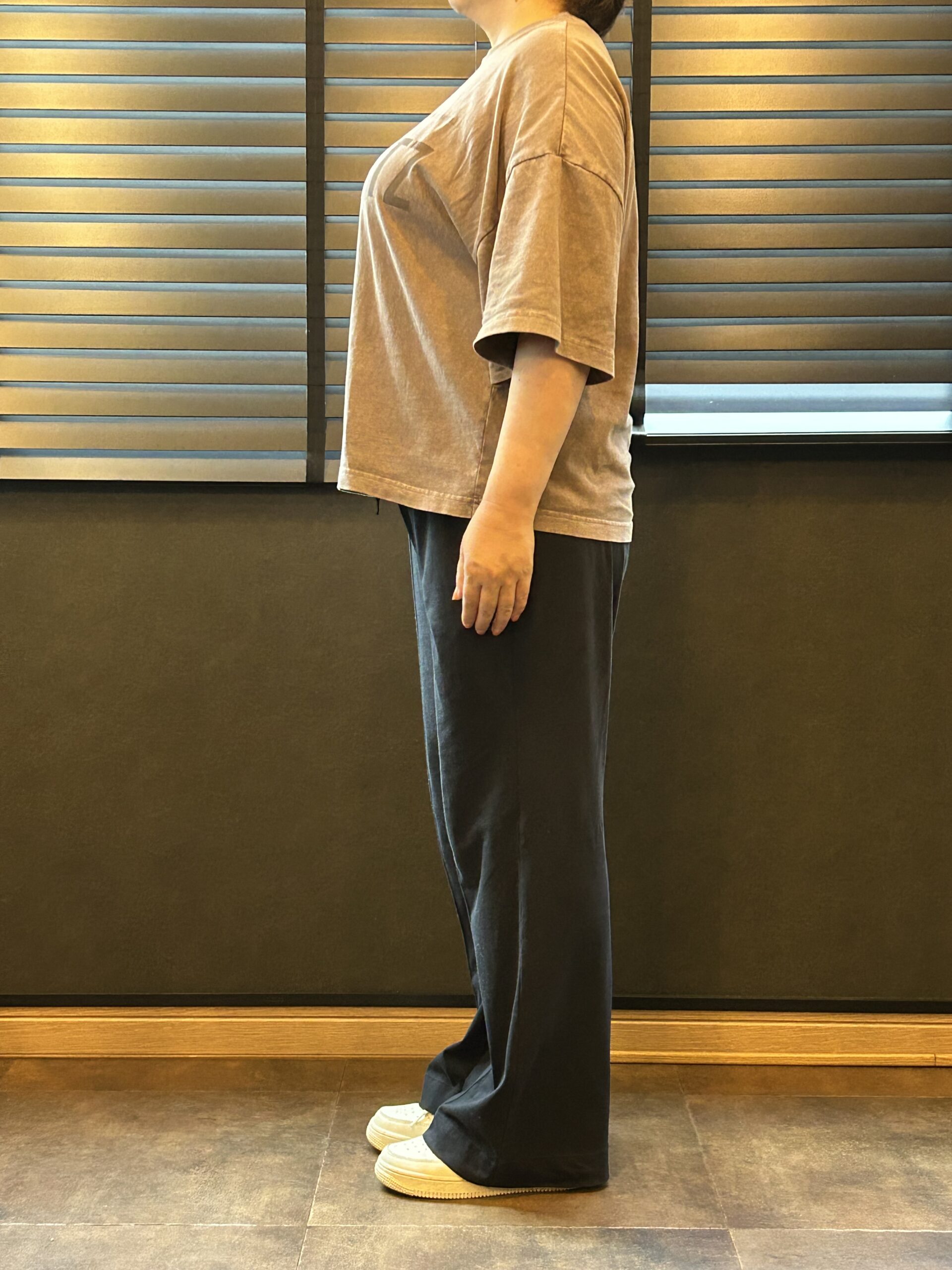 女性モニター様 ビフォー 側面